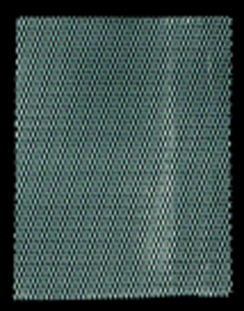 Aluminum Contour Expandable Metal Mesh