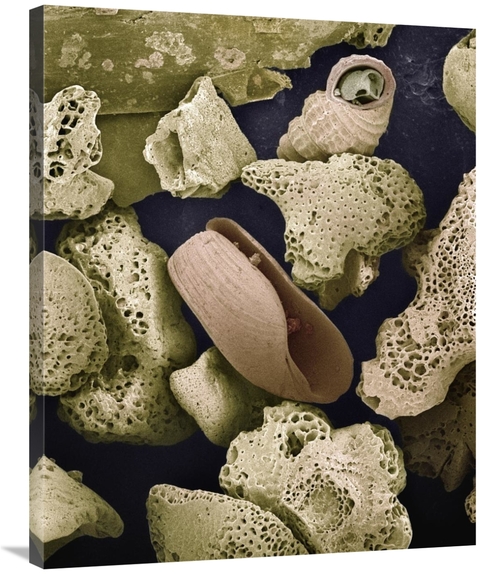 Global Gallery GCS-397628-2835-142 28 x 35 in. Foraminiferans, Mol