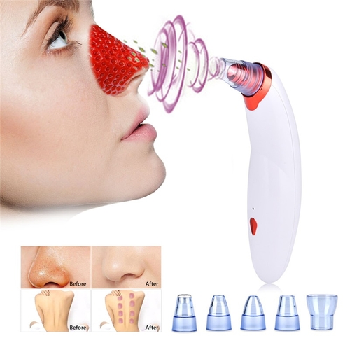 Body Cupping Blackhead Remove Vacuum Suction Face