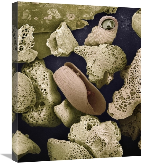 Global Gallery GCS-397628-2024-142 20 x 24 in. Foraminiferans, Mol